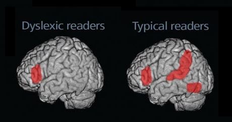 brain drawings